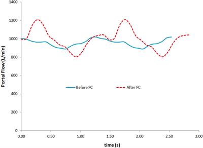 Portal Vein Pulsatility Index as a Potential Risk of Venous Congestion Assessed by Magnetic Resonance Imaging: A Prospective Study on Healthy Volunteers